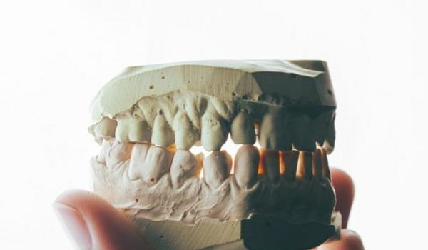 חריקת שיניים בשינה: האם בהכרח תופעה שלילית ומזיקה . סקירה דוסיז צרכנות